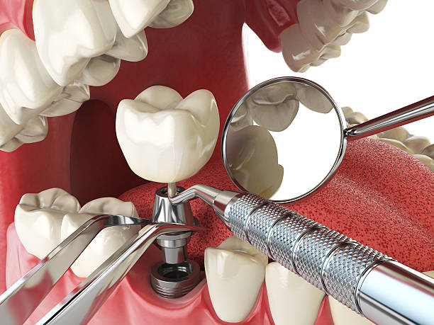 Best Knocked-Out Tooth Emergency  in Smyrna, TN